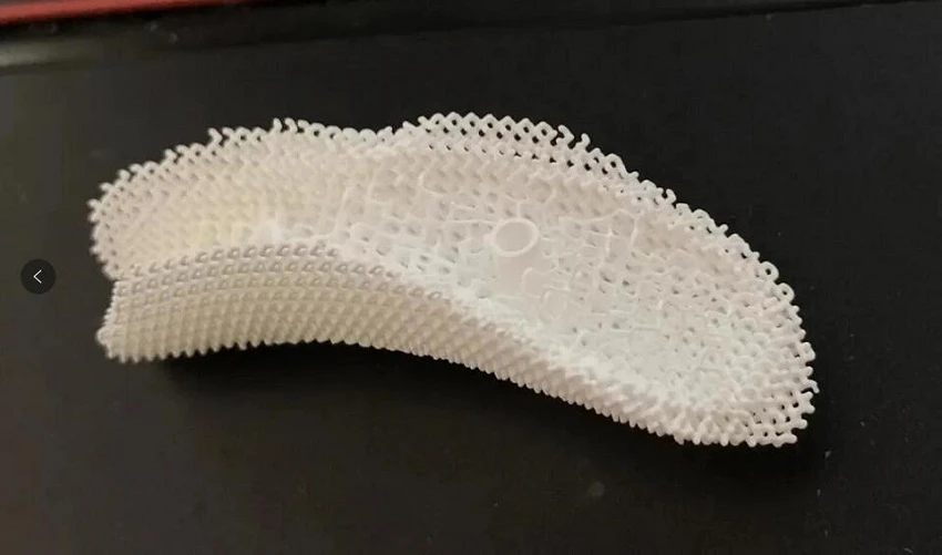 3D printed skull implants 3D printed skull implants